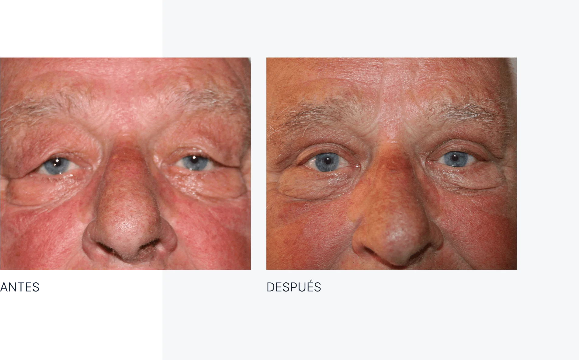 img-antes-despues-01