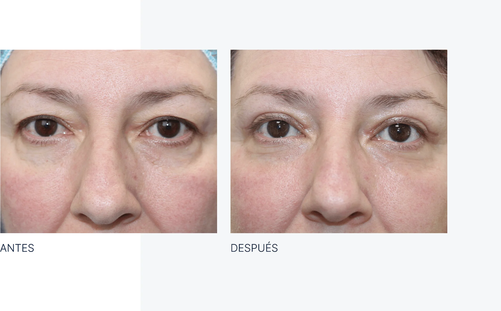 img-antes-despues-02