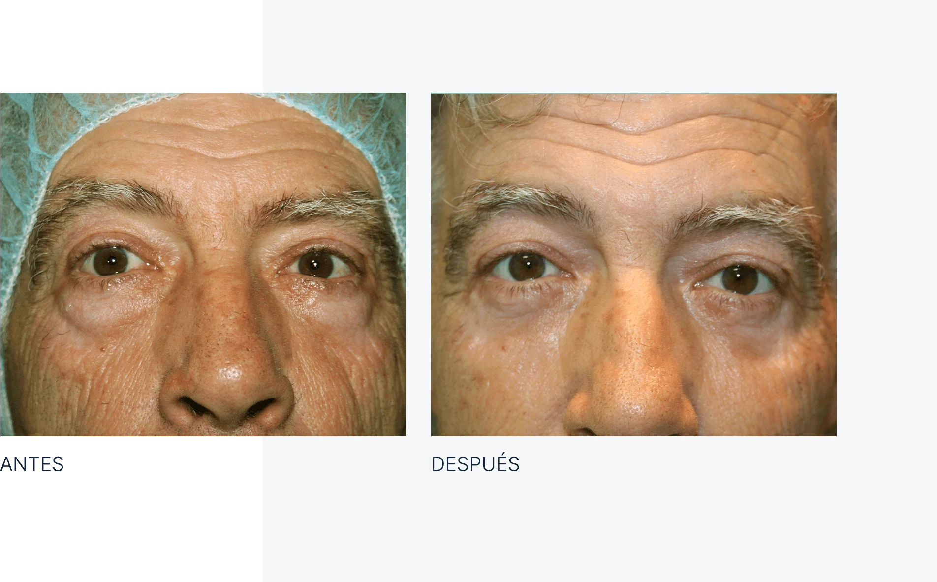 img-antes-despues-03