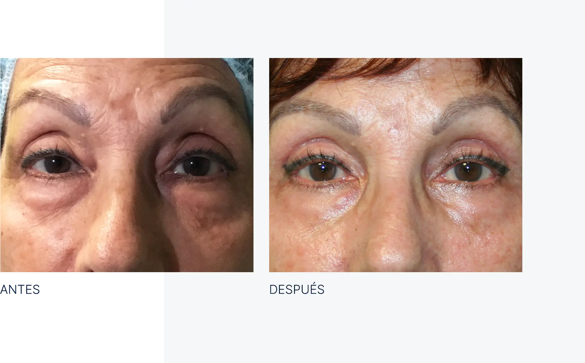 img-antes-despues-04