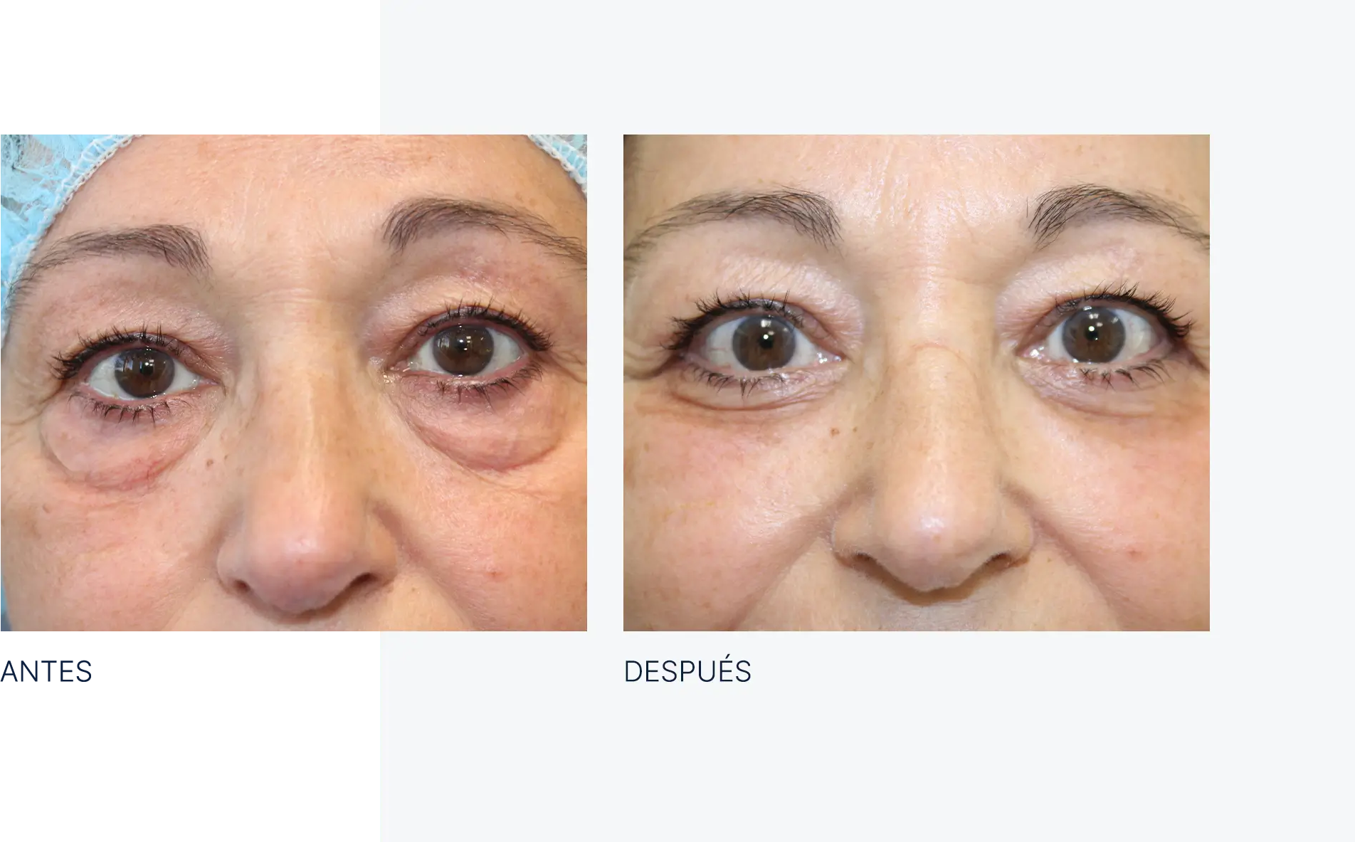 img-antes-despues-05