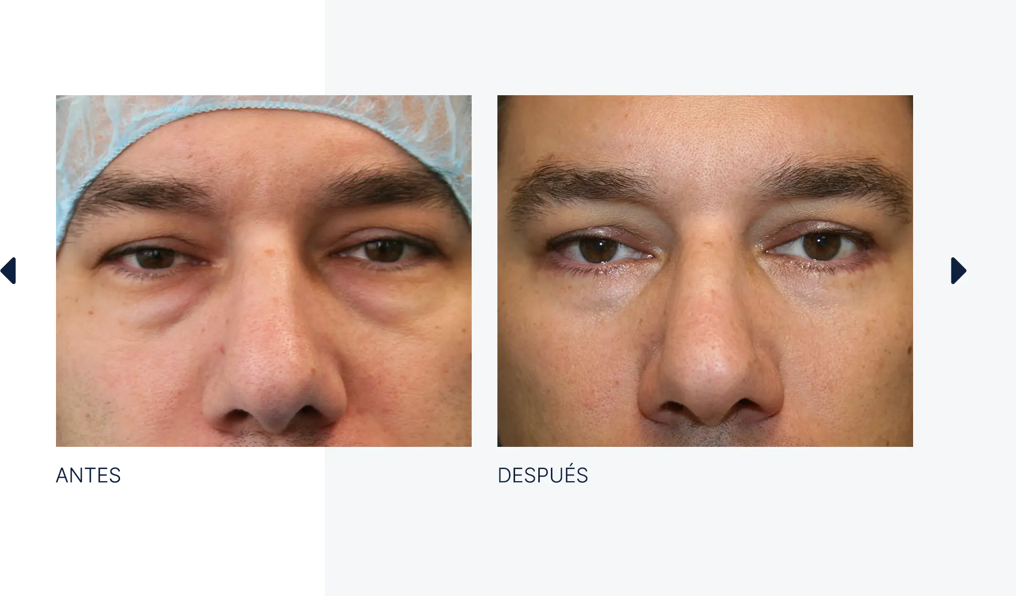 img-antes-despues-06