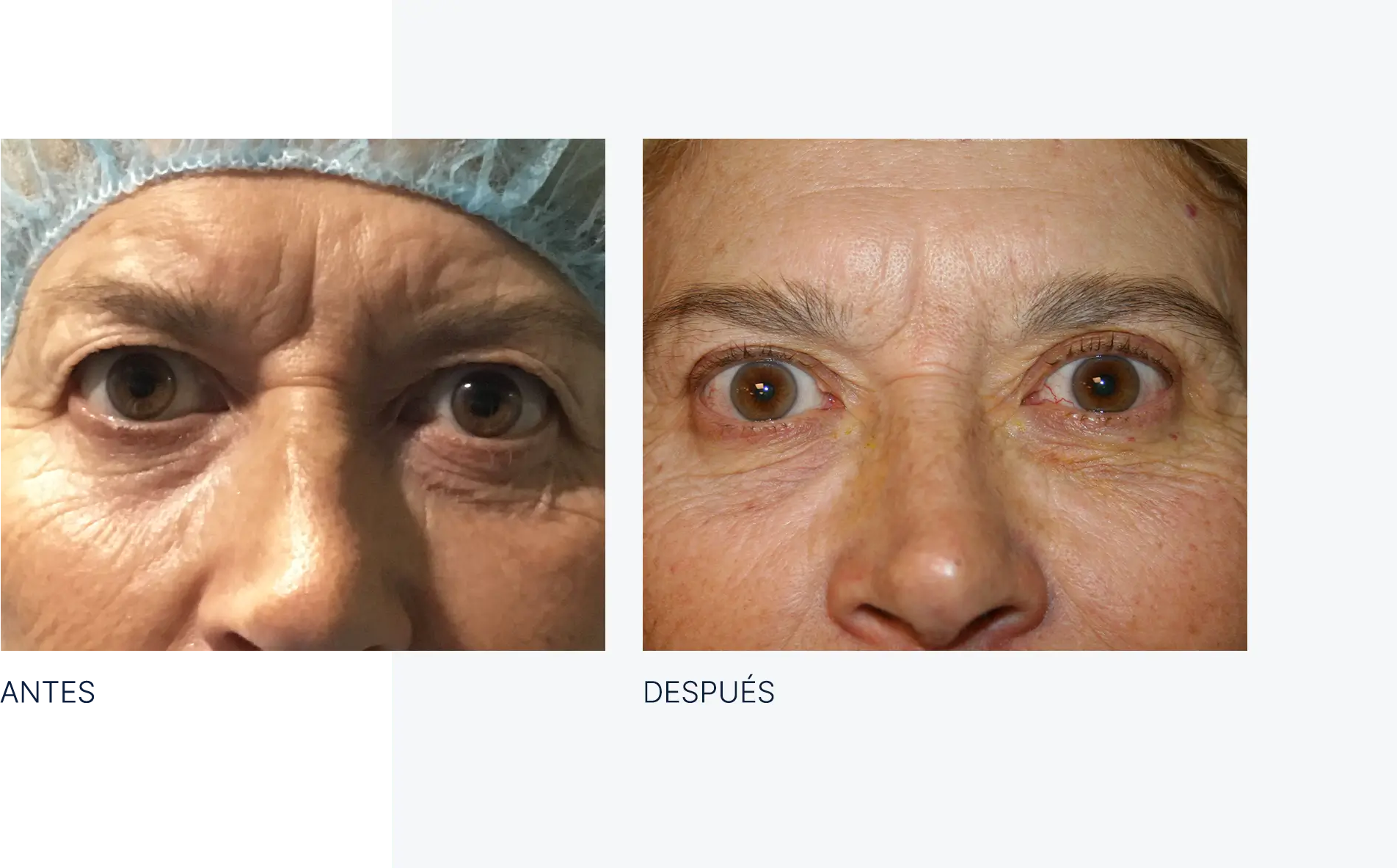 img-antes-despues-07