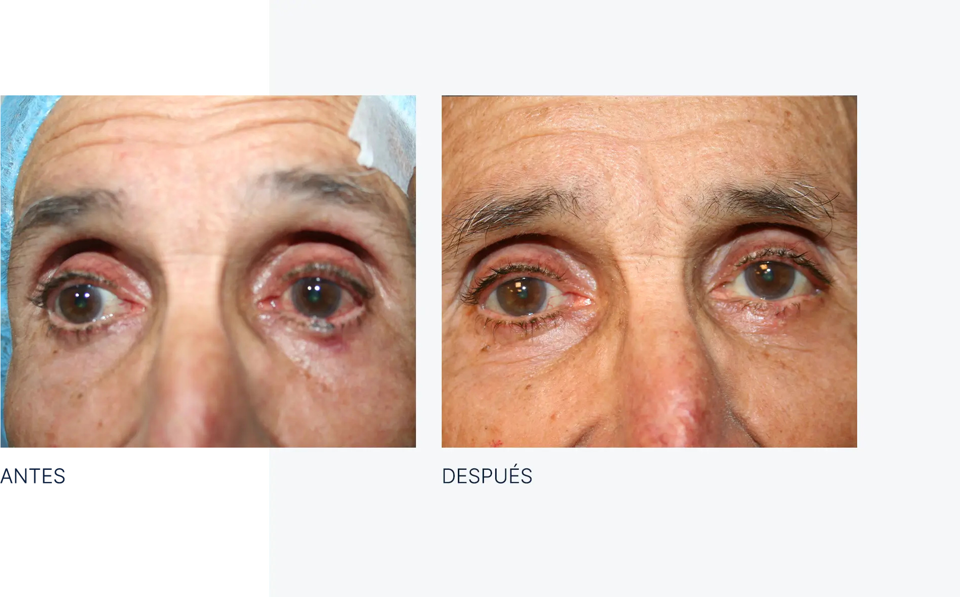 img-antes-despues-tumores-01