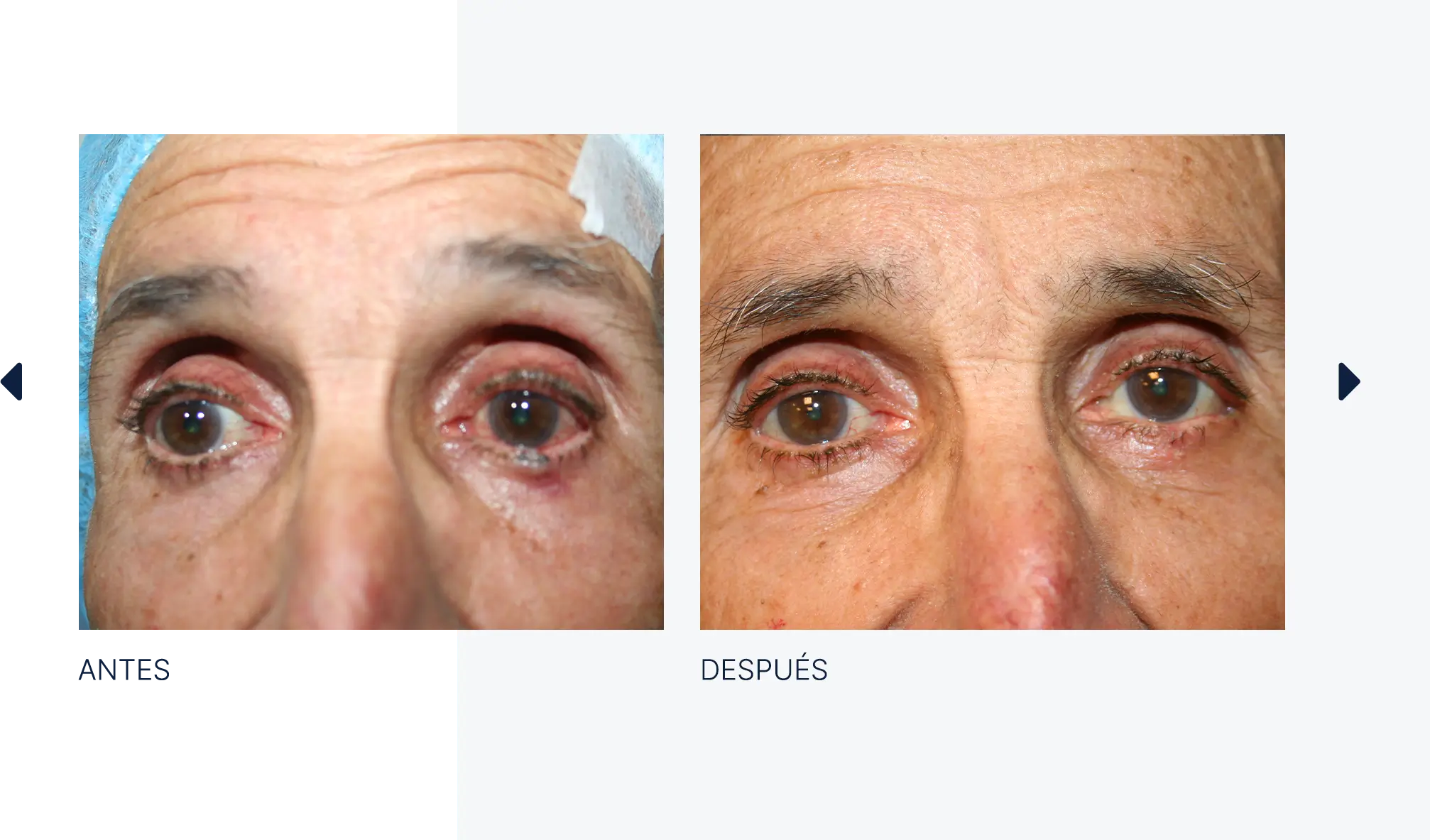 img-antes-despues-tumores-01