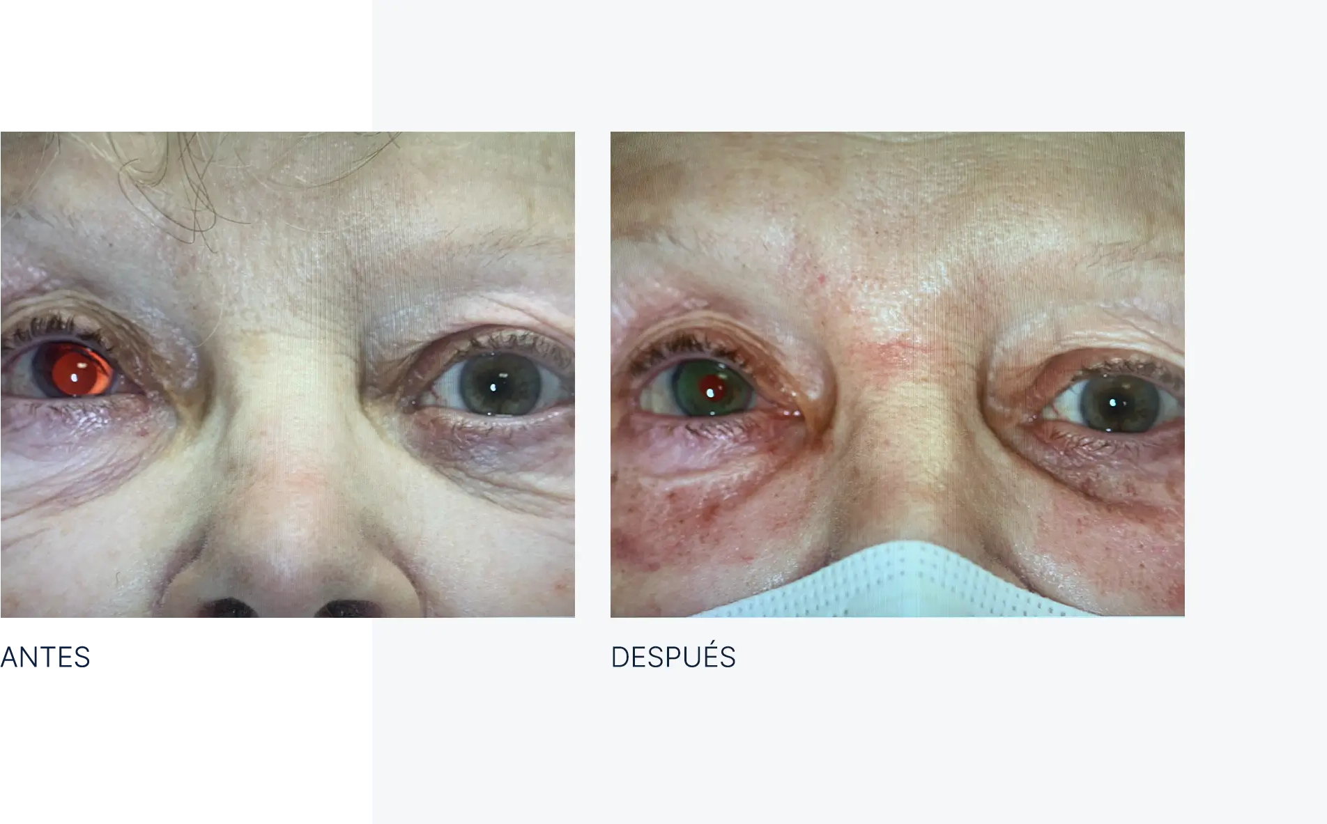 img-antes-despues-tumores-02